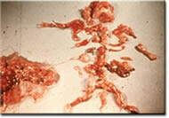 Dilation and Evacuation