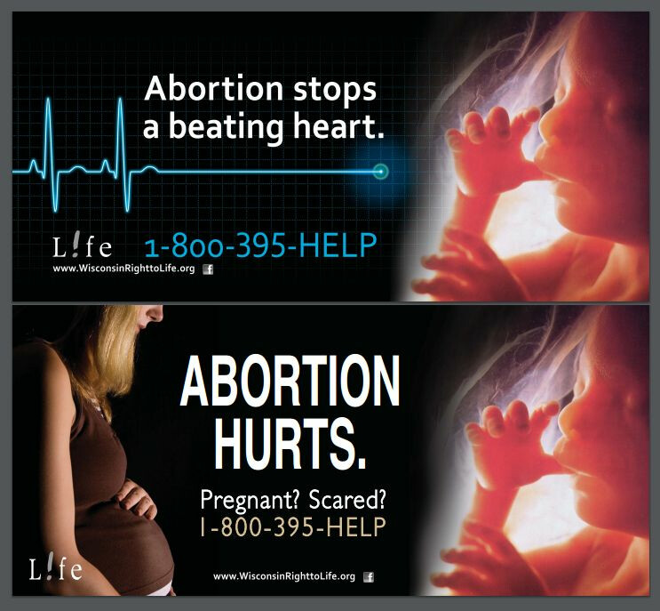 outdoor billboards by Wisconsin Right to Life